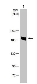 Western blot - Anti-Blooms Syndrome Protein Blm antibody (AB226945)