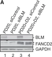 Western blot - Anti-Blooms Syndrome Protein Blm antibody (AB476)