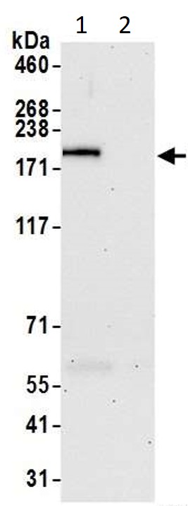 Immunoprecipitation - Anti-Blooms Syndrome Protein Blm antibody (AB5446)