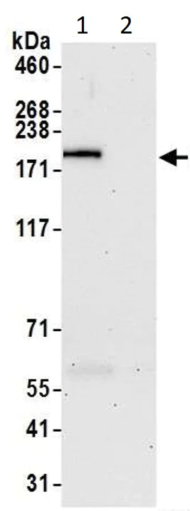 Immunoprecipitation - Anti-Blooms Syndrome Protein Blm antibody (AB5446)