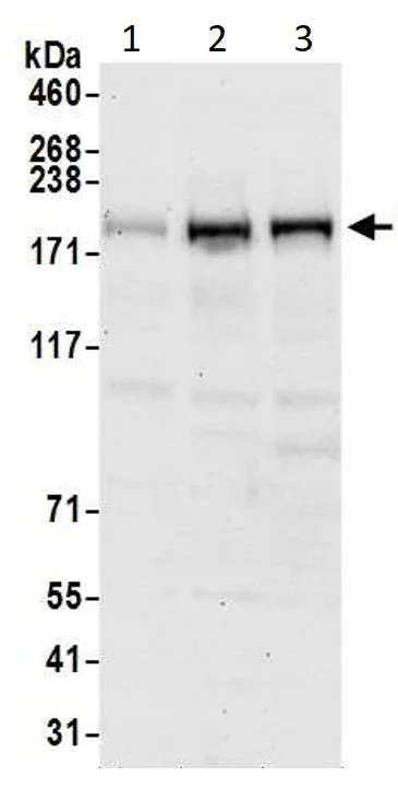 Western blot - Anti-Blooms Syndrome Protein Blm antibody (AB5446)