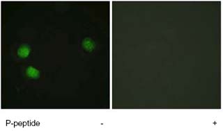 Immunocytochemistry/ Immunofluorescence - Anti-Blooms Syndrome Protein Blm (phospho T99) antibody (AB62206)