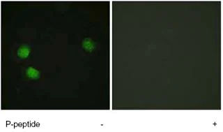 Immunocytochemistry/ Immunofluorescence - Anti-Blooms Syndrome Protein Blm (phospho T99) antibody (AB62206)