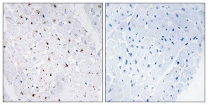 Immunohistochemistry (Formalin/PFA-fixed paraffin-embedded sections) - Anti-Blooms Syndrome Protein Blm (phospho T99) antibody (AB62206)