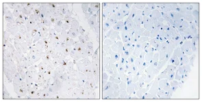 Immunohistochemistry (Formalin/PFA-fixed paraffin-embedded sections) - Anti-Blooms Syndrome Protein Blm (phospho T99) antibody (AB62206)