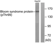 Western blot - Anti-Blooms Syndrome Protein Blm (phospho T99) antibody (AB62206)