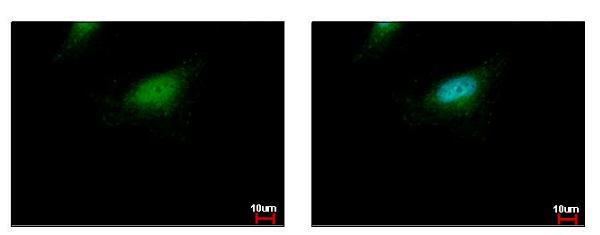 Immunocytochemistry/ Immunofluorescence - Anti-BLZF1 antibody (AB155510)