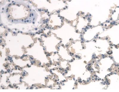 Immunohistochemistry (Formalin/PFA-fixed paraffin-embedded sections) - Anti-BMAL1 antibody (AB231793)