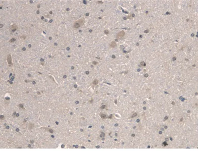 Immunohistochemistry (Formalin/PFA-fixed paraffin-embedded sections) - Anti-BMAL1 antibody (AB231793)