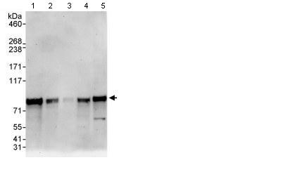 Western blot - Anti-BMAL1 antibody (AB93806), expandable thumbnail