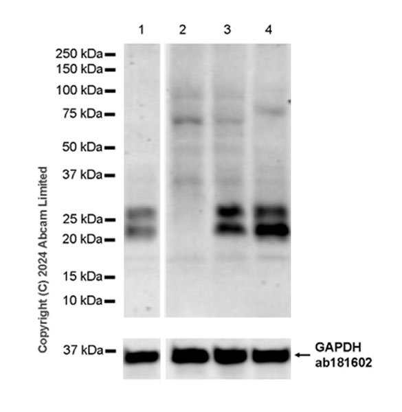 Western blot - Anti-Bmf antibody [EPR29055-176] (AB322407), expandable thumbnail