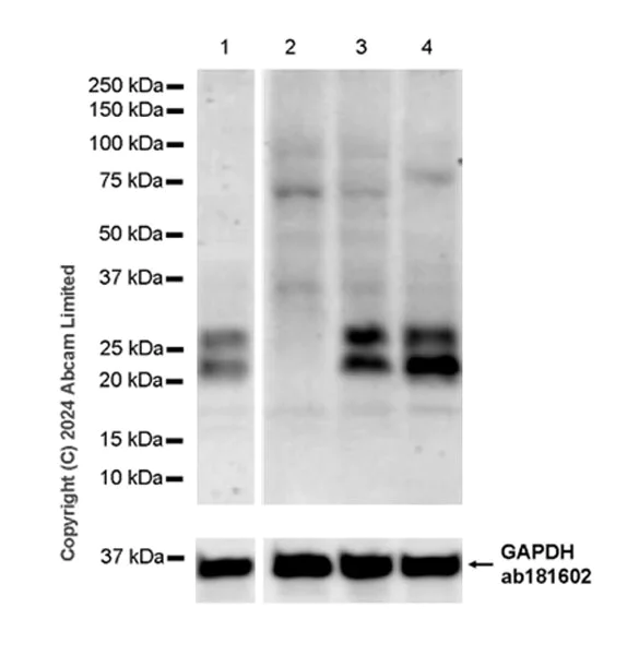 Western blot - Anti-Bmf antibody [EPR29055-176] (AB322407)