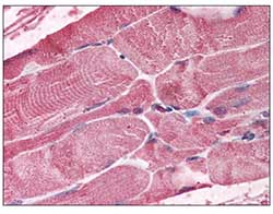 Immunohistochemistry (Formalin/PFA-fixed paraffin-embedded sections) - Anti-Bmi1 antibody (AB115251)