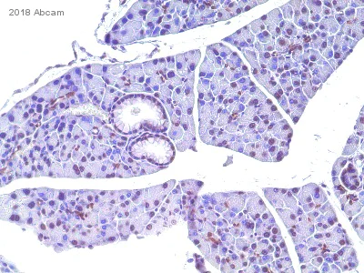 Immunohistochemistry (Formalin/PFA-fixed paraffin-embedded sections) - Anti-Bmi1 antibody (AB115251)