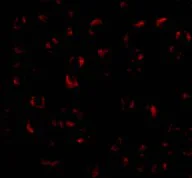 Immunocytochemistry/ Immunofluorescence - Anti-Bmi1 antibody (AB38295)