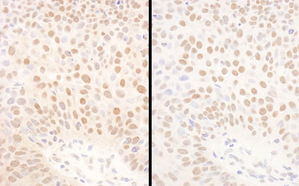 Immunohistochemistry (Formalin/PFA-fixed paraffin-embedded sections) - Anti-Bmi1 antibody (AB85688)