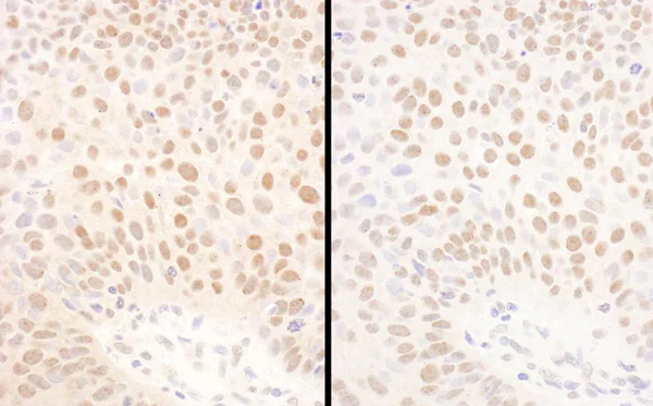 Immunohistochemistry (Formalin/PFA-fixed paraffin-embedded sections) - Anti-Bmi1 antibody (AB85688)