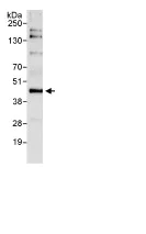 Immunoprecipitation - Anti-Bmi1 antibody (AB85688)