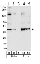 Western blot - Anti-Bmi1 antibody (AB85688)
