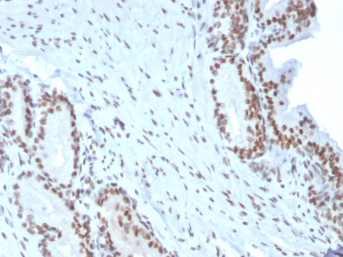 Immunohistochemistry (Formalin/PFA-fixed paraffin-embedded sections) - Anti-Bmi1 antibody [BMI1/2823] - BSA and Azide free (AB269688)