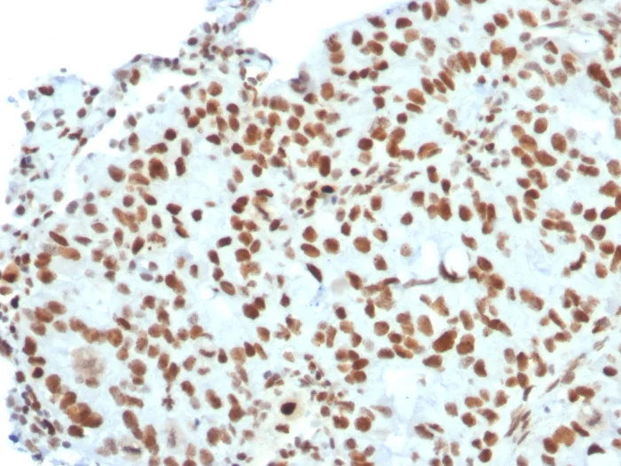 Immunohistochemistry (Formalin/PFA-fixed paraffin-embedded sections) - Anti-Bmi1 antibody [BMI1/2823] - BSA and Azide free (AB269688)