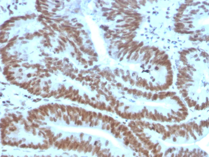 Immunohistochemistry (Formalin/PFA-fixed paraffin-embedded sections) - Anti-Bmi1 antibody [BMI1/2823] - BSA and Azide free (AB269688)