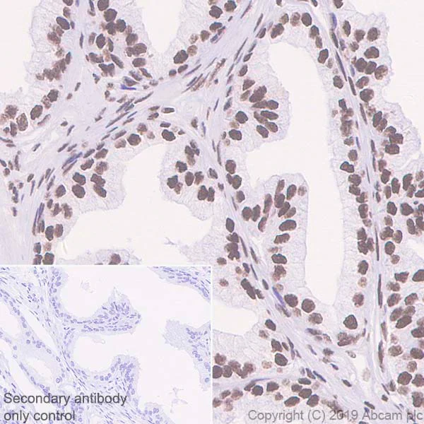 Immunohistochemistry (Formalin/PFA-fixed paraffin-embedded sections) - Anti-Bmi1 antibody [EPR22604-160] - ChIP Grade (AB254253)