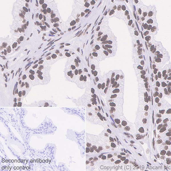 Immunohistochemistry (Formalin/PFA-fixed paraffin-embedded sections) - Anti-Bmi1 antibody [EPR22604-160] - ChIP Grade - BSA and Azide free (AB254475), expandable thumbnail
