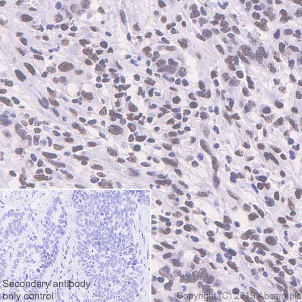 Immunohistochemistry (Formalin/PFA-fixed paraffin-embedded sections) - Anti-Bmi1 antibody [EPR22604-160] - ChIP Grade - BSA and Azide free (ab254475), expandable thumbnail