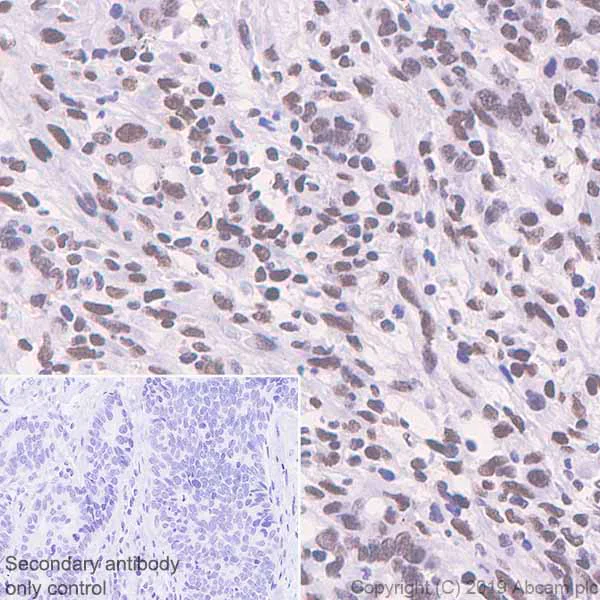 Immunohistochemistry (Formalin/PFA-fixed paraffin-embedded sections) - Anti-Bmi1 antibody [EPR22604-160] - ChIP Grade - BSA and Azide free (AB254475)