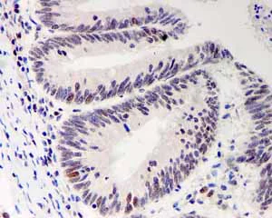 Immunohistochemistry (Formalin/PFA-fixed paraffin-embedded sections) - Anti-Bmi1 antibody [EPR3745(2)] (AB126783)