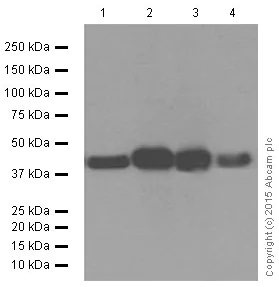 Western blot - Anti-Bmi1 antibody [EPR3745(2)] (AB126783)