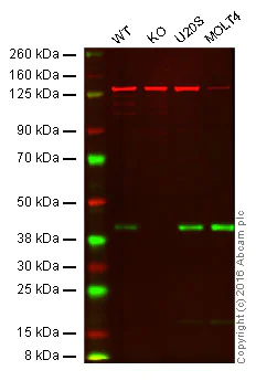 Western blot - Anti-Bmi1 antibody [EPR3745(2)] (AB126783)