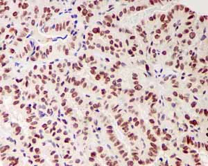 Immunohistochemistry (Formalin/PFA-fixed paraffin-embedded sections) - Anti-Bmi1 antibody [EPR3745(2)] - BSA and Azide free (AB216444)