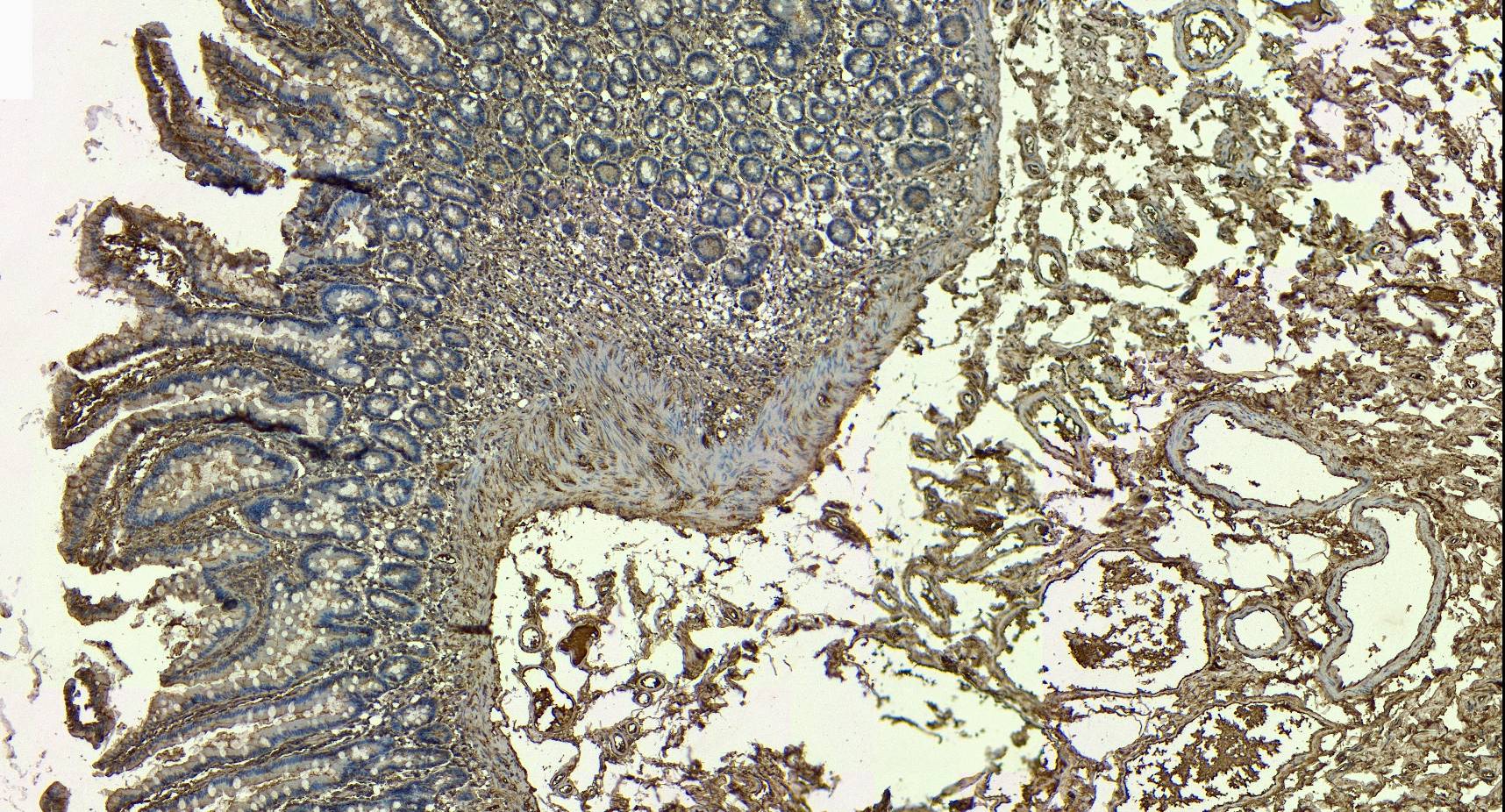 Immunohistochemistry (Formalin/PFA-fixed paraffin-embedded sections) - Anti-BMP1/PCP antibody (AB205394), expandable thumbnail