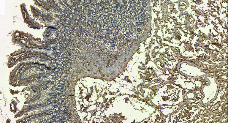 Immunohistochemistry (Formalin/PFA-fixed paraffin-embedded sections) - Anti-BMP1/PCP antibody (AB205394)
