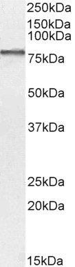 Western blot - Anti-BMP1/PCP antibody (AB205394), expandable thumbnail