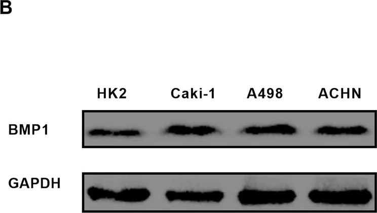 Western blot - Anti-BMP1/PCP antibody (AB205394)