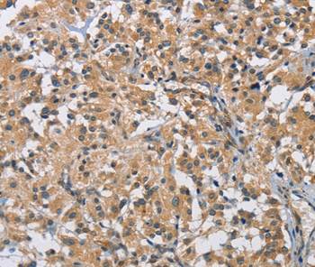 Immunohistochemistry (Formalin/PFA-fixed paraffin-embedded sections) - Anti-BMP15 antibody (AB198226), expandable thumbnail