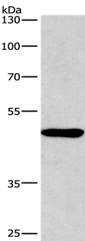Western blot - Anti-BMP15 antibody (AB198226), expandable thumbnail