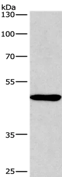 Western blot - Anti-BMP15 antibody (AB198226)