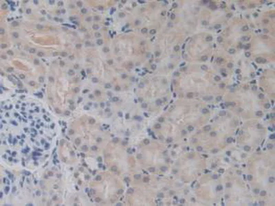 Immunohistochemistry (Formalin/PFA-fixed paraffin-embedded sections) - Anti-BMP15 antibody (AB231261)