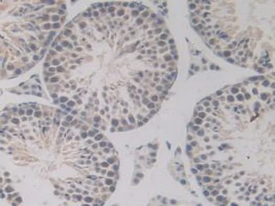 Immunohistochemistry (Formalin/PFA-fixed paraffin-embedded sections) - Anti-BMP15 antibody (AB231261)