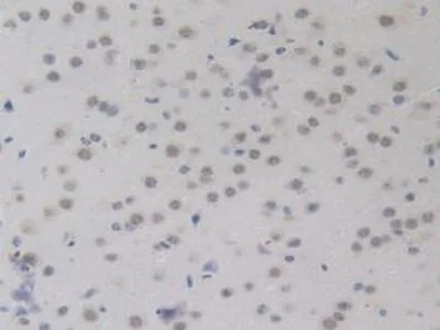 Immunohistochemistry (Formalin/PFA-fixed paraffin-embedded sections) - Anti-BMP15 antibody (AB231261)