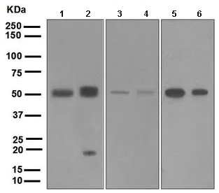 Western blot - Anti-BMP15 antibody [EPR5137] (AB108413)