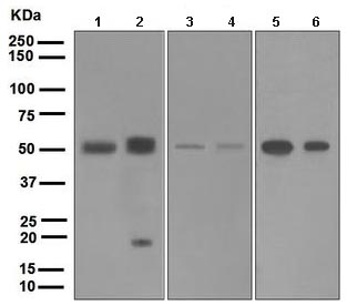 Western blot - Anti-BMP15 antibody [EPR5137] - BSA and Azide free (AB247662), expandable thumbnail