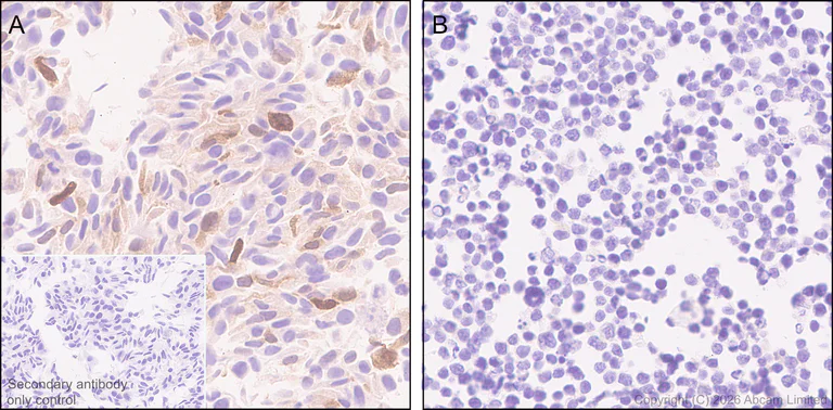 Immunohistochemistry (Formalin/PFA-fixed paraffin-embedded sections) - Anti-BMP2 antibody [EPR30246-26] (AB325708)