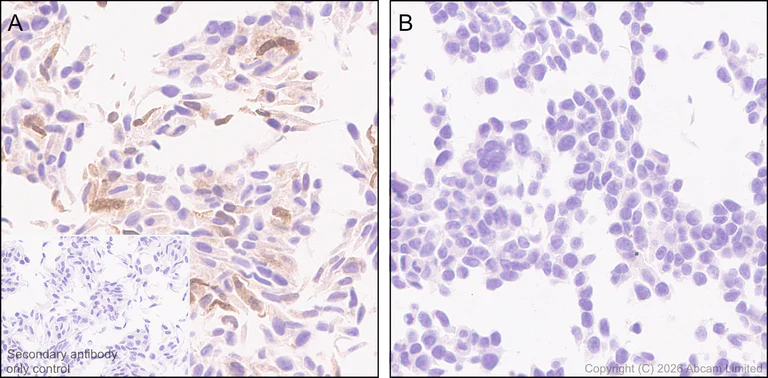 Immunohistochemistry (Formalin/PFA-fixed paraffin-embedded sections) - Anti-BMP2 antibody [EPR30246-26] (AB325708)