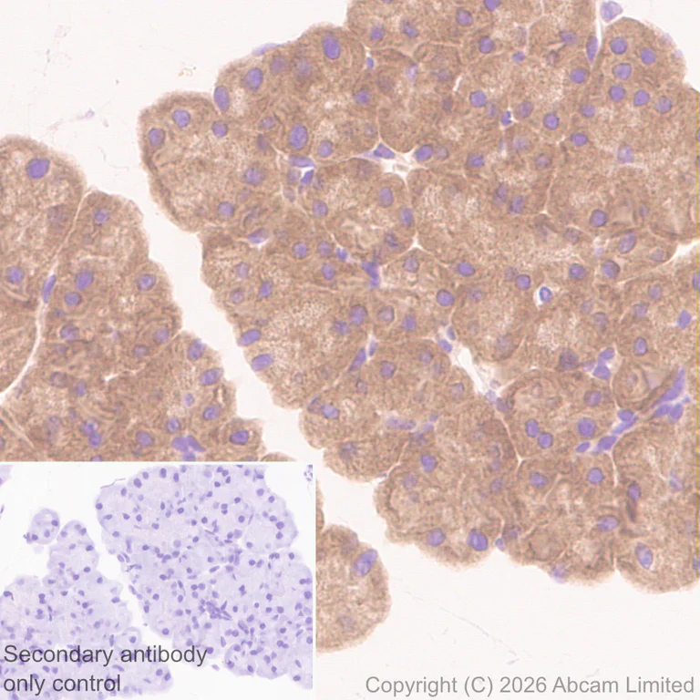 Immunohistochemistry (Formalin/PFA-fixed paraffin-embedded sections) - Anti-BMP2 antibody [EPR30246-26] (AB325708)