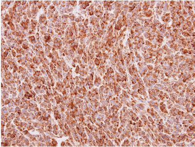 Immunohistochemistry (Formalin/PFA-fixed paraffin-embedded sections) - Anti-BMP4 antibody (AB155033), expandable thumbnail